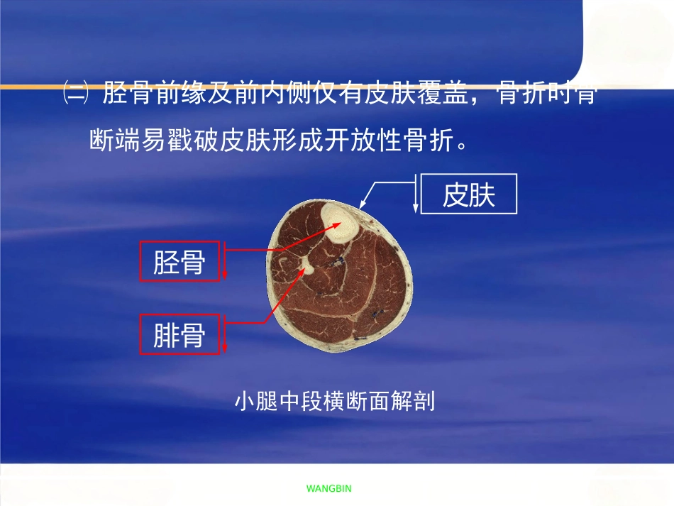 胫腓骨 骨折急诊处理_第6页
