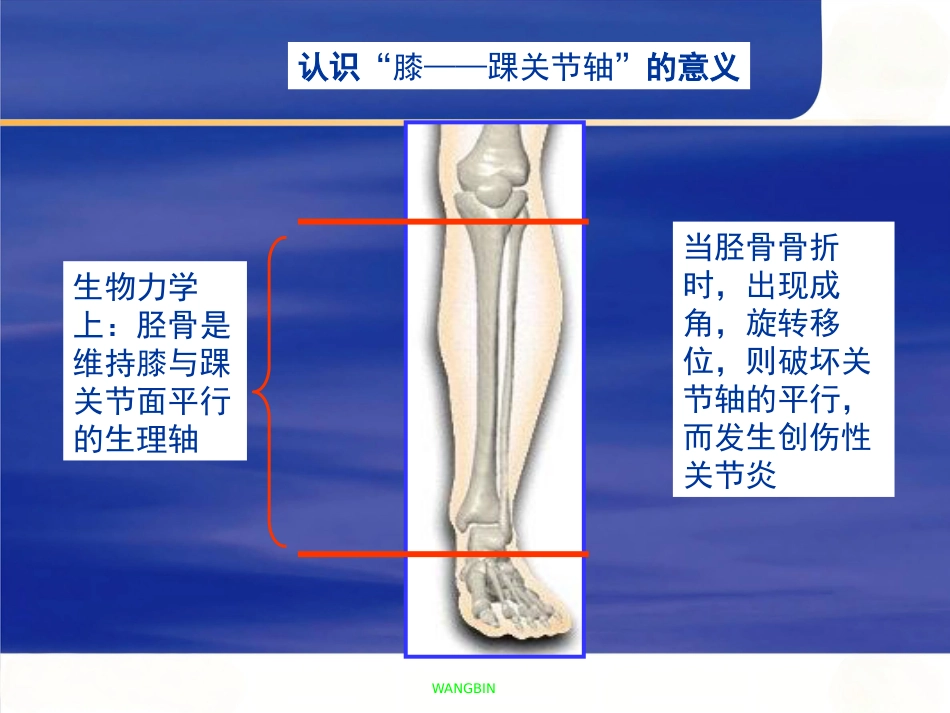 胫腓骨 骨折急诊处理_第8页