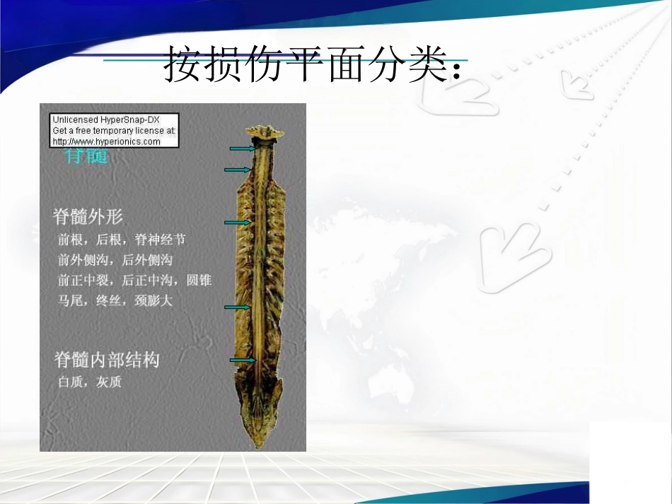 脊髓损伤的 康复_第14页