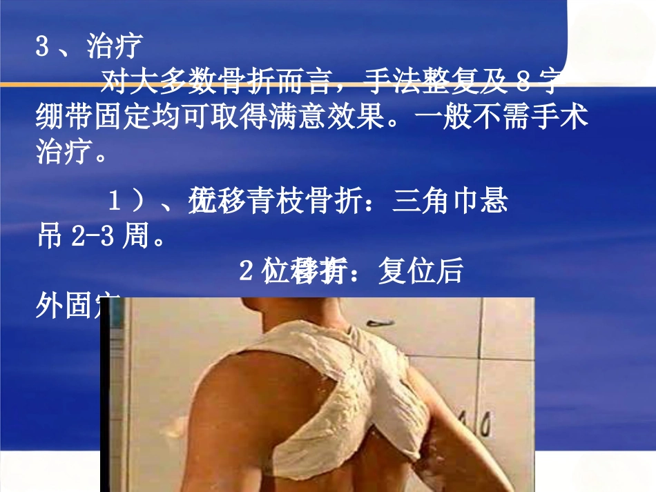 上肢骨 折_第5页