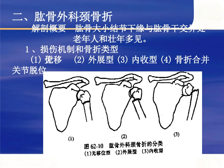 上肢骨 折_第9页