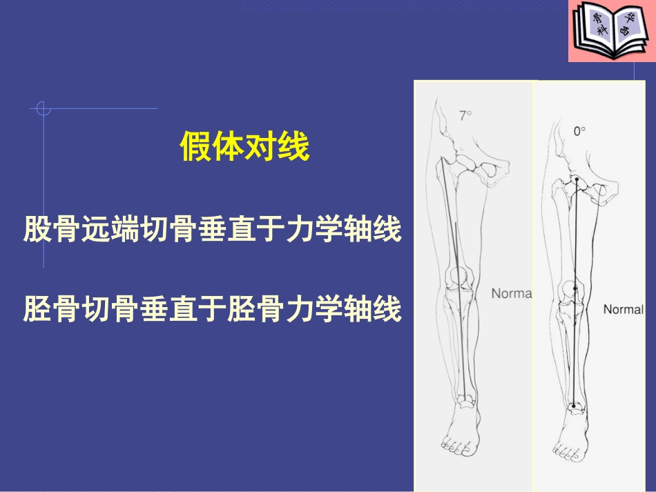 全膝关节置换的基本原则及技术要点_第11页