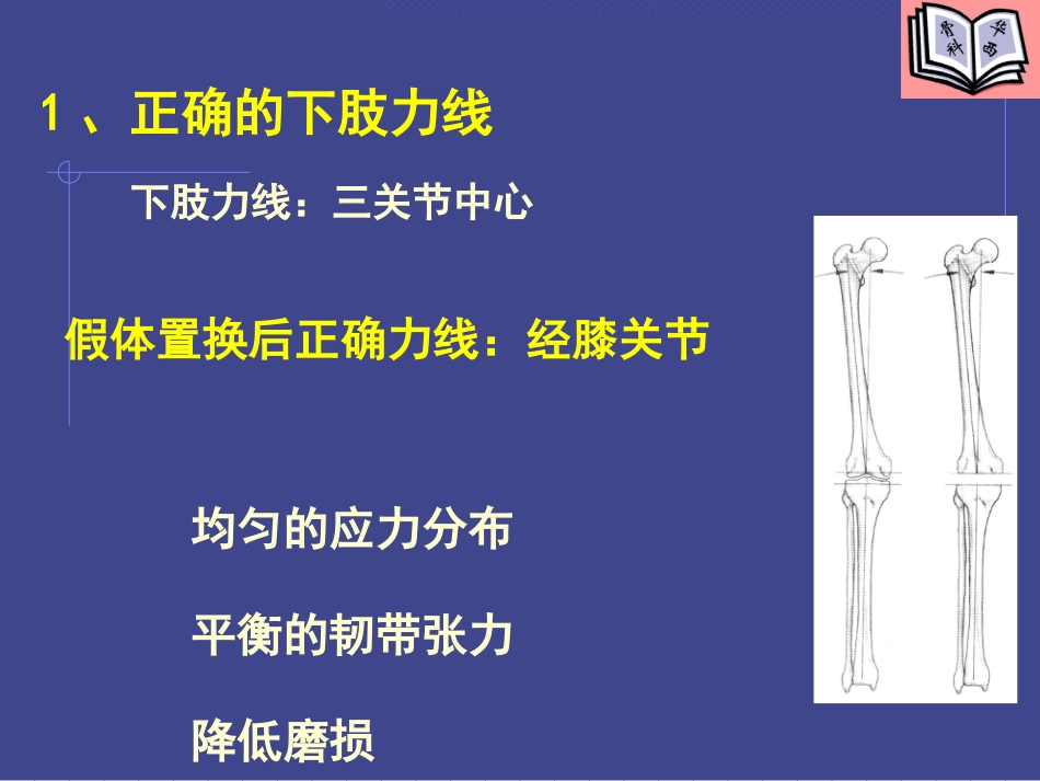 全膝关节置换的基本原则及技术要点_第7页