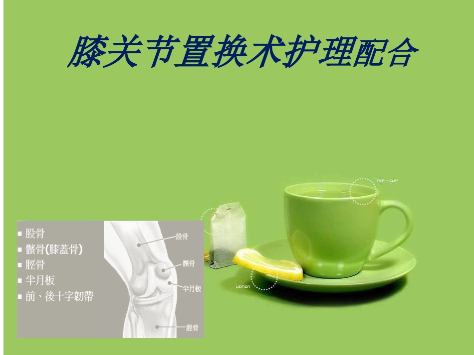 人工膝关节表面 置换术的配合_第1页