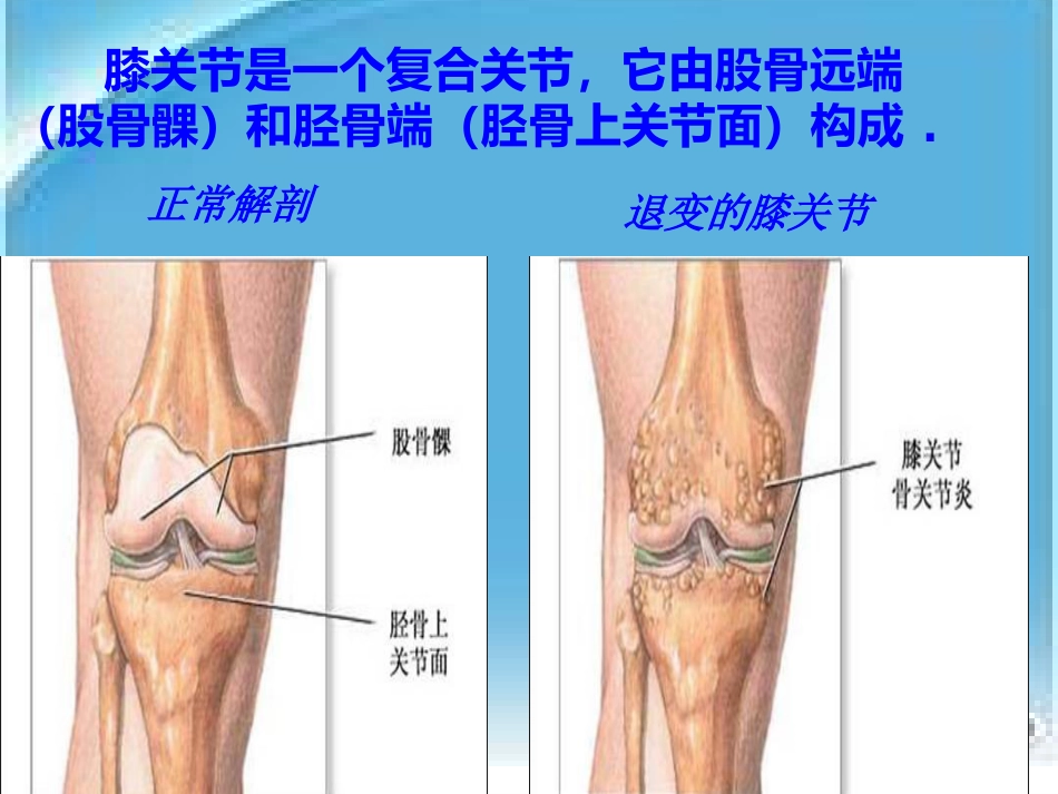 人工膝关节表面 置换术的配合_第8页