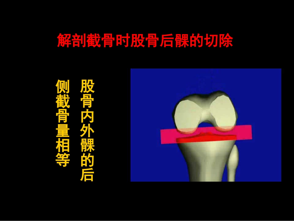 截骨力 线_第10页