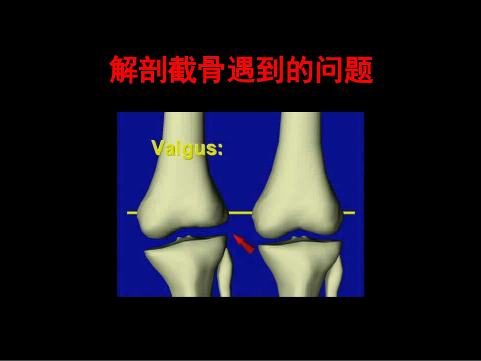 截骨力 线_第14页
