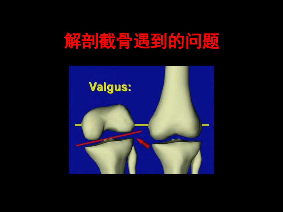 截骨力 线_第15页