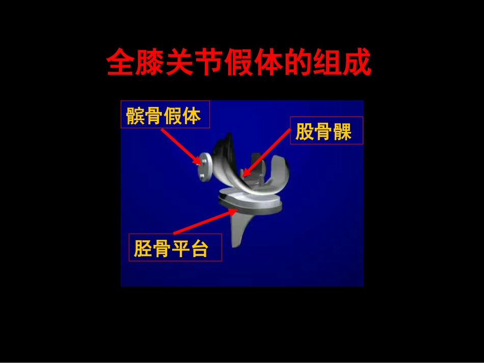 截骨力 线_第3页