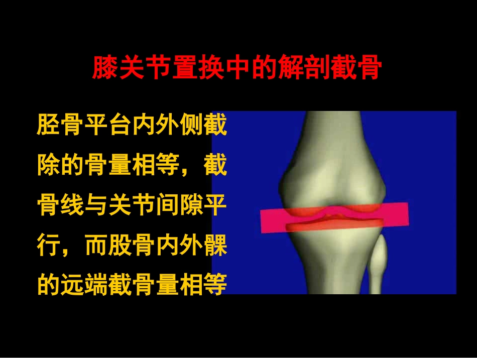 截骨力 线_第8页