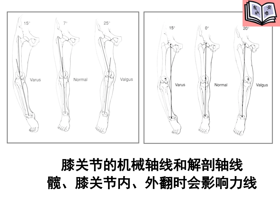 全膝关节置换的手术原则 (3)_第5页