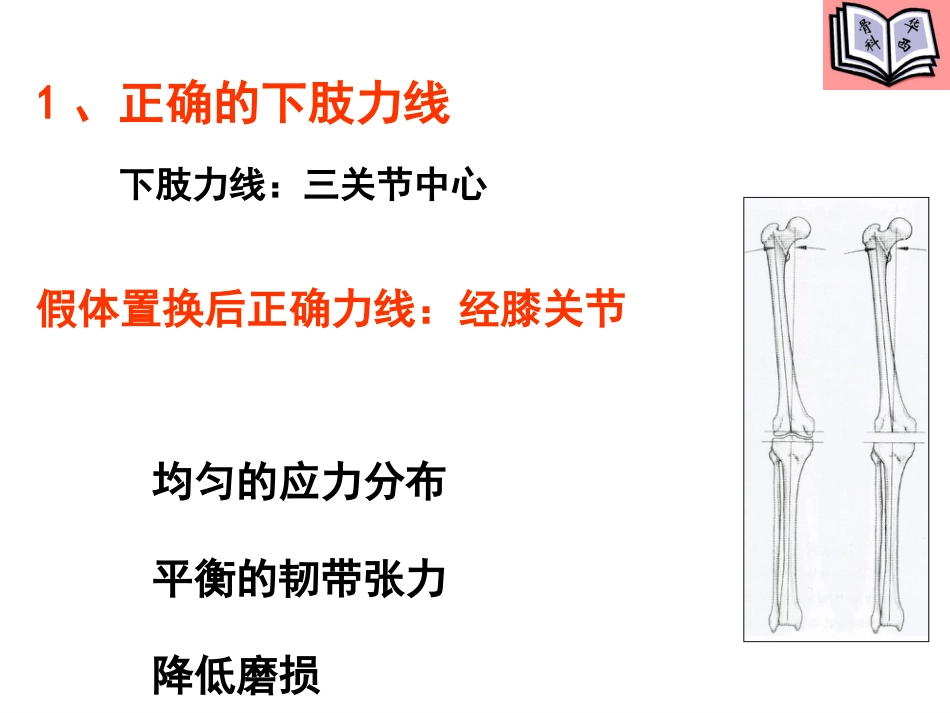 全膝关节置换的手术原则 (4)_第4页