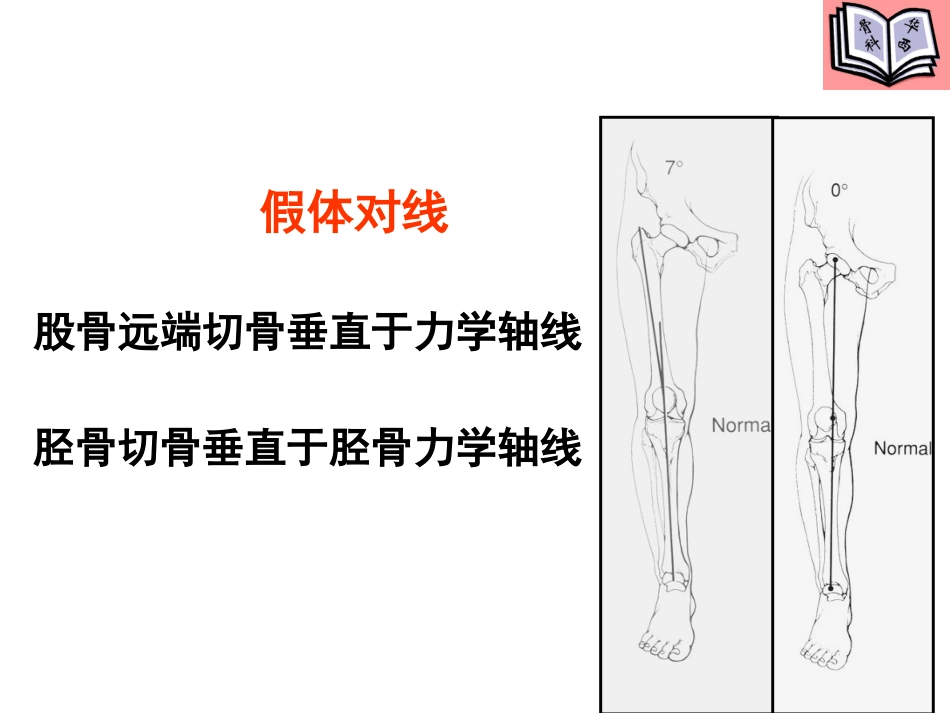 全膝关节置换的手术原则(5)_第7页