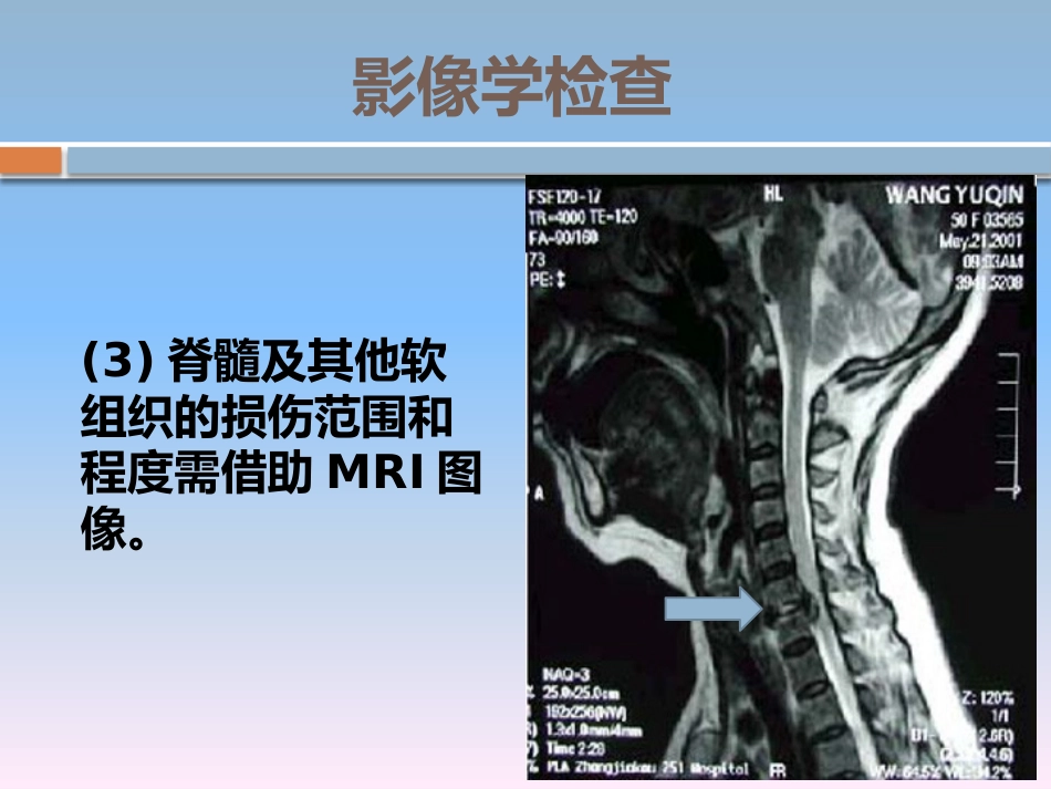 颈椎骨折的 护理_第12页