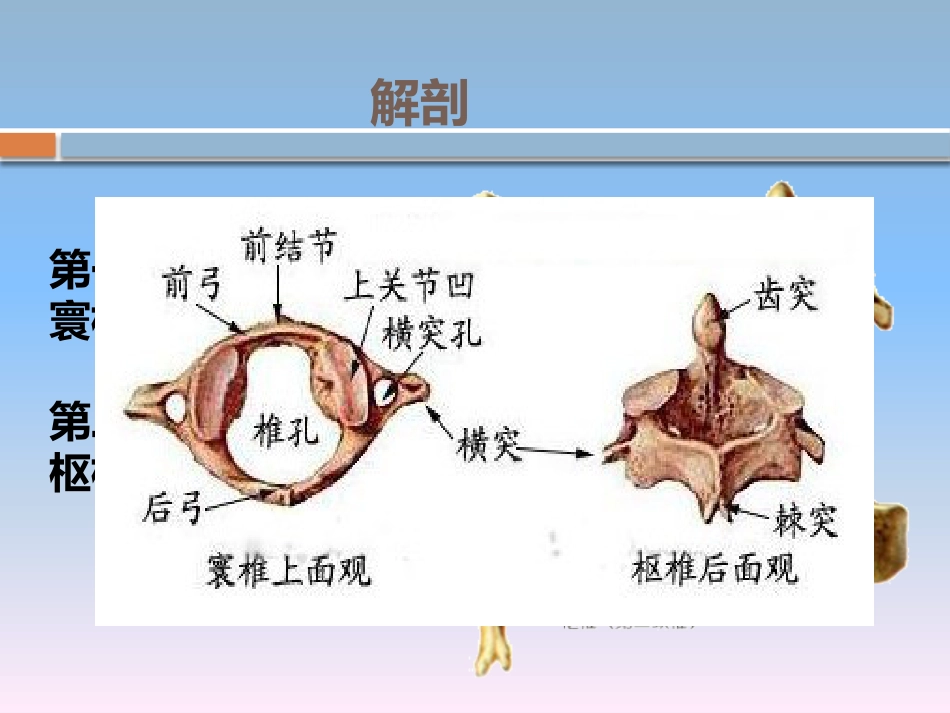 颈椎骨折的 护理_第6页