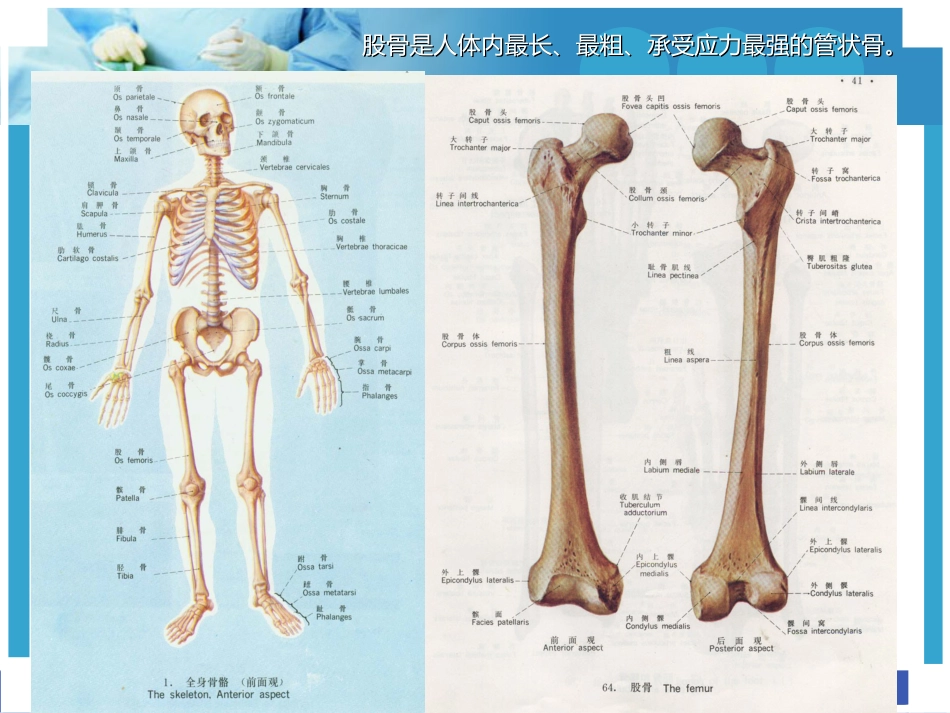 股骨干骨折护理ppt_第2页