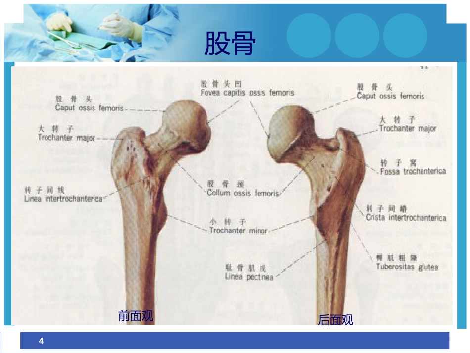 股骨干骨折护理ppt_第4页