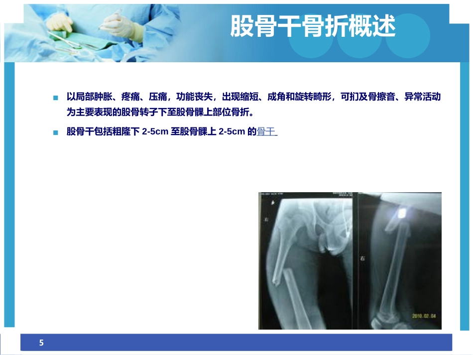 股骨干骨折护理ppt_第5页