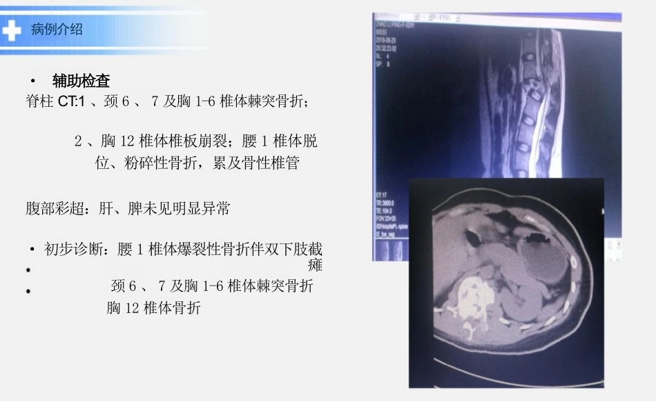 脊髓损伤教学查房ppt_第5页