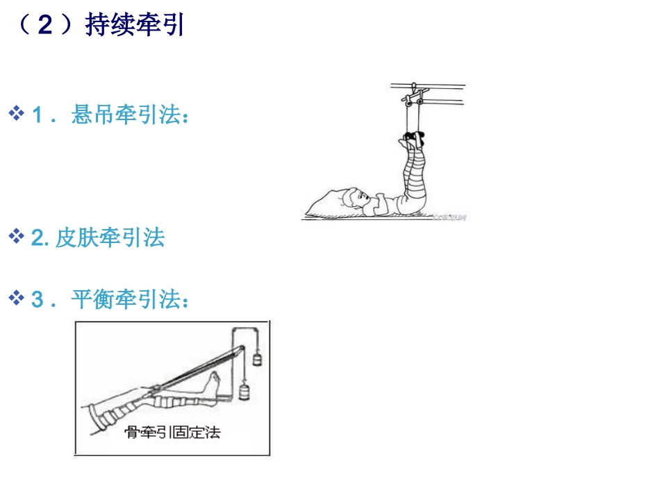 股骨干 骨折护理_第13页