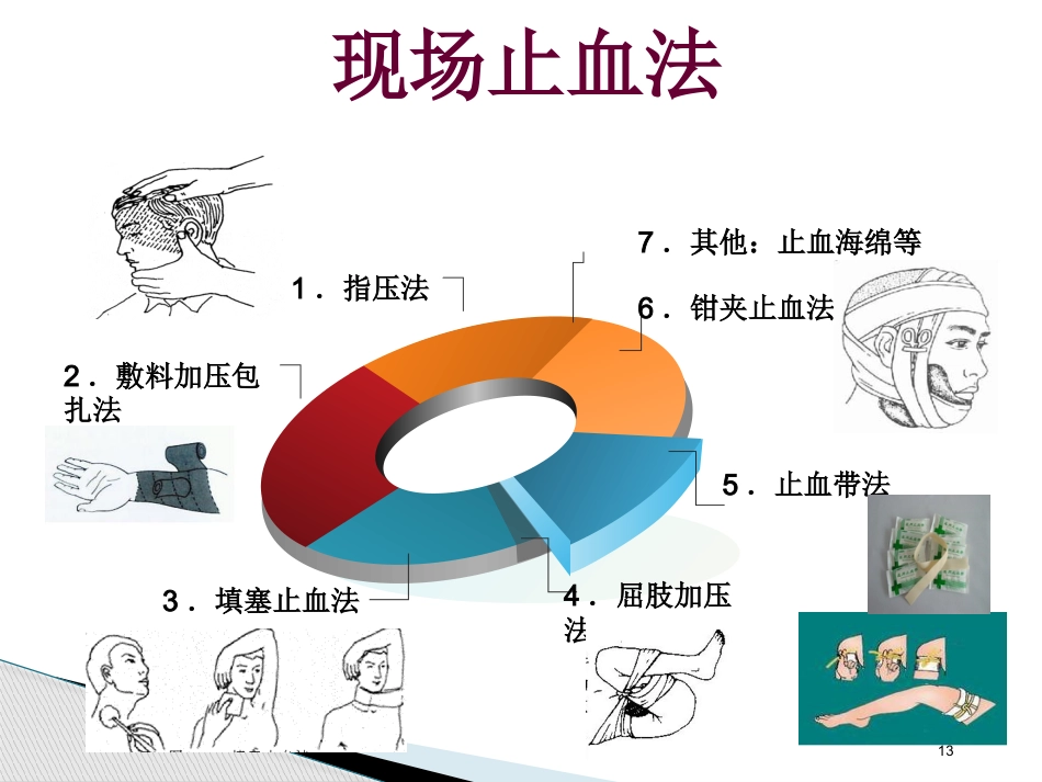 创伤急救止血包扎ppt_第13页