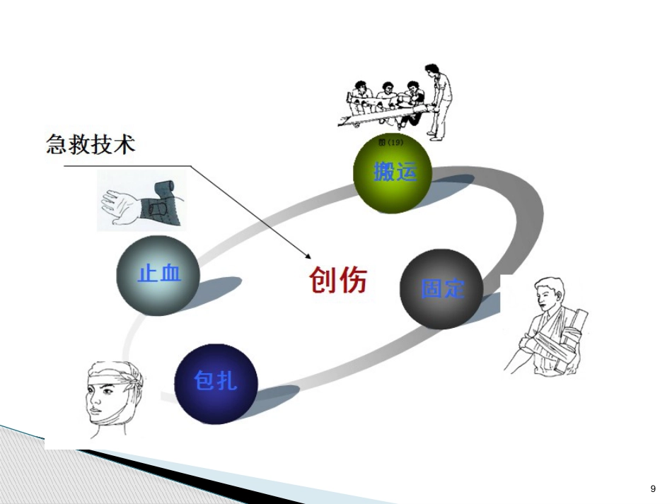 创伤急救止血包扎ppt_第9页