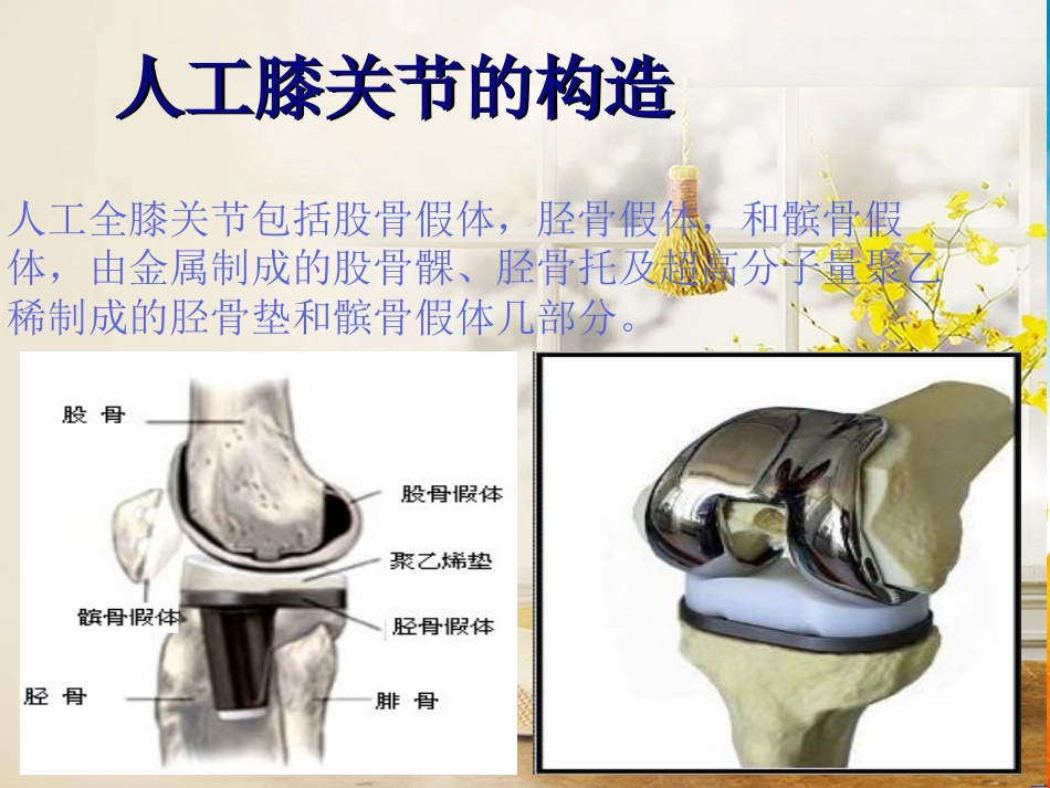 全膝关节置换术 护理及康复_第5页