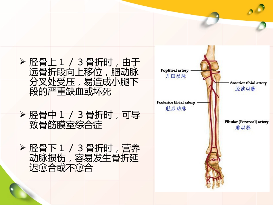 胫腓骨 骨折患者的护理_第12页