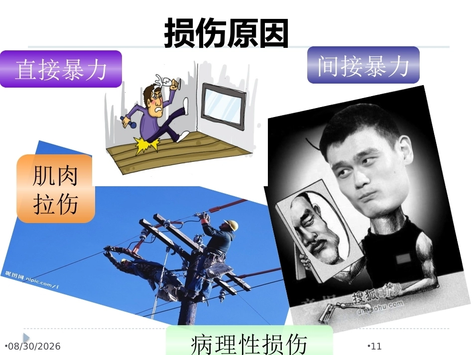 腰椎骨折 患者的护理PPT_第11页