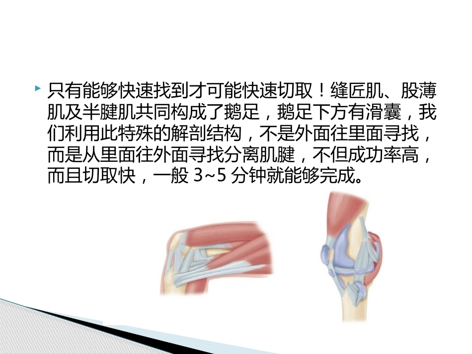 如何能够快速切取腘绳肌腱_第4页