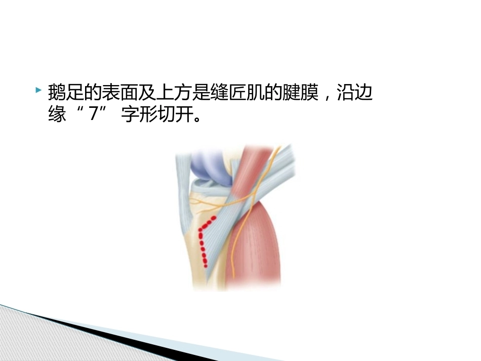 如何能够快速切取腘绳肌腱_第9页