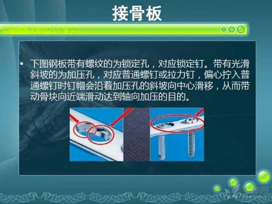 骨科精品课件-骨折内固定_第11页