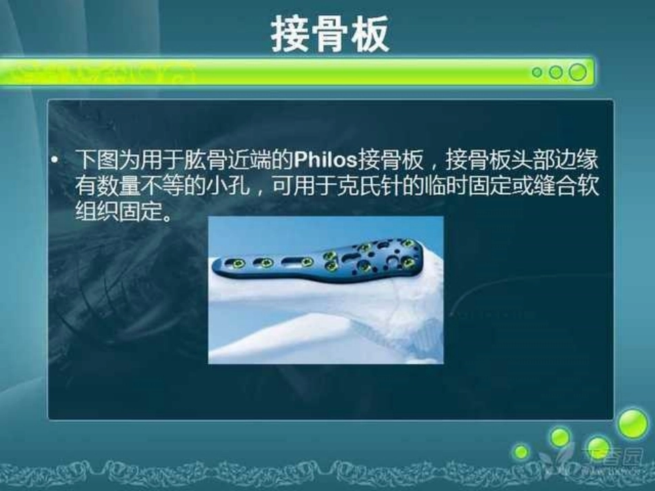 骨科精品课件-骨折内固定_第13页