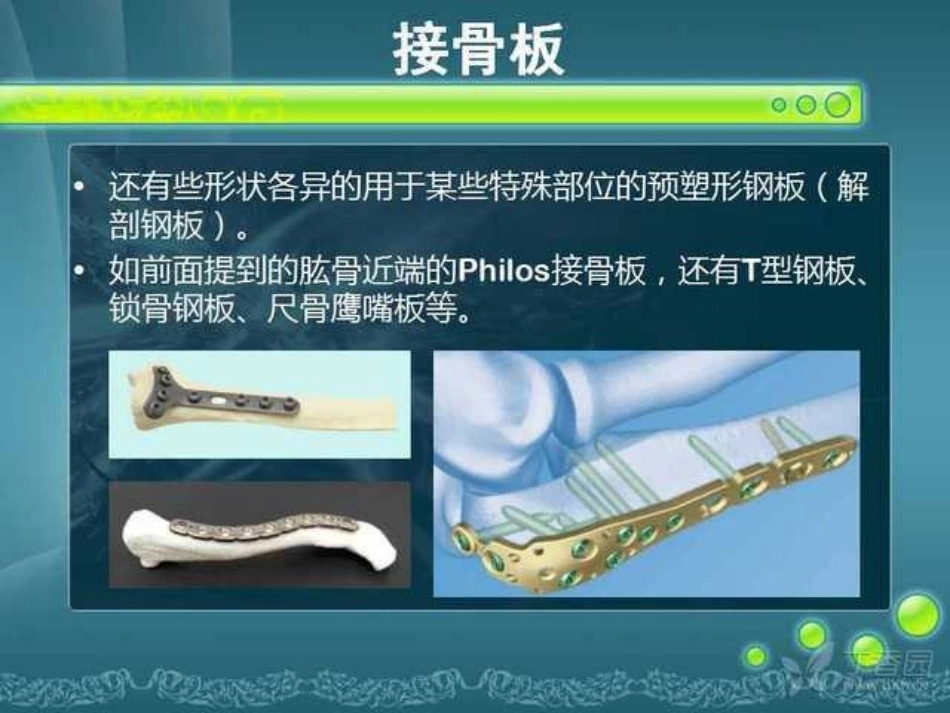 骨科精品课件-骨折内固定_第14页