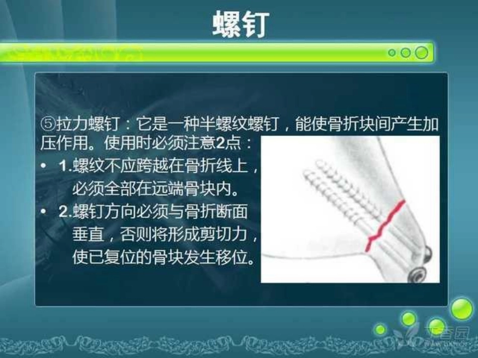 骨科精品课件-骨折内固定_第7页