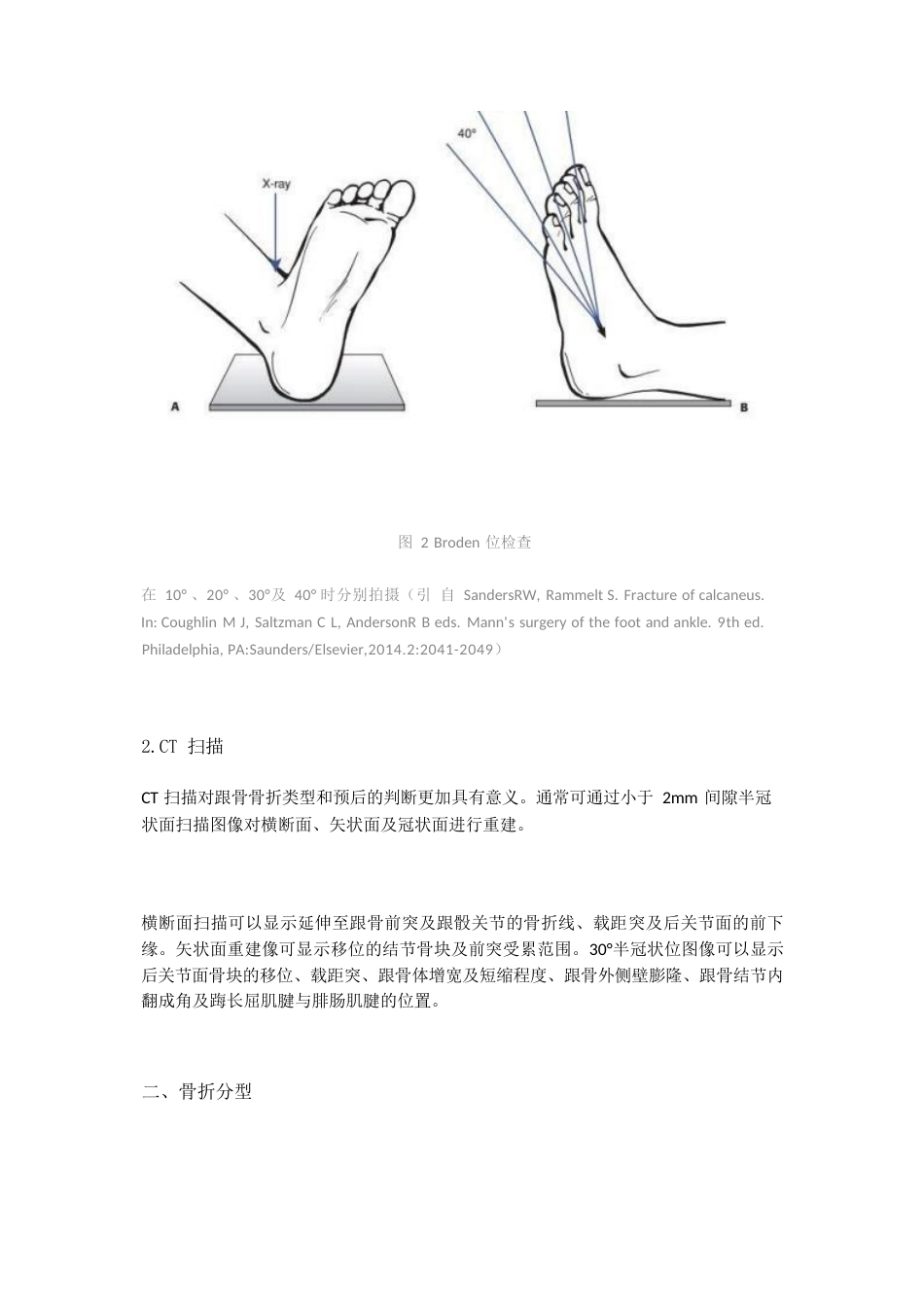 跟骨骨折的影像学检查与分型_第3页