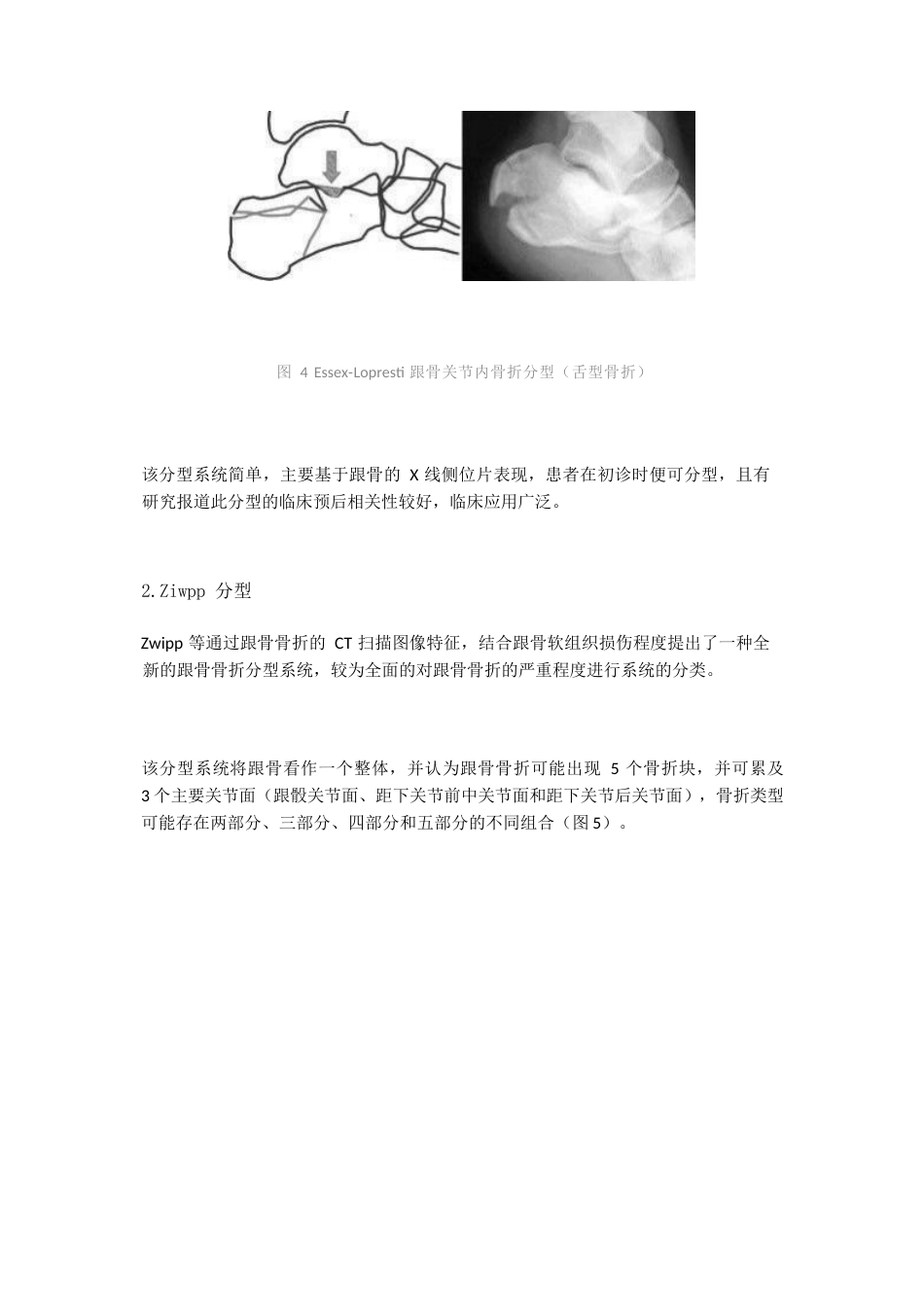 跟骨骨折的影像学检查与分型_第5页