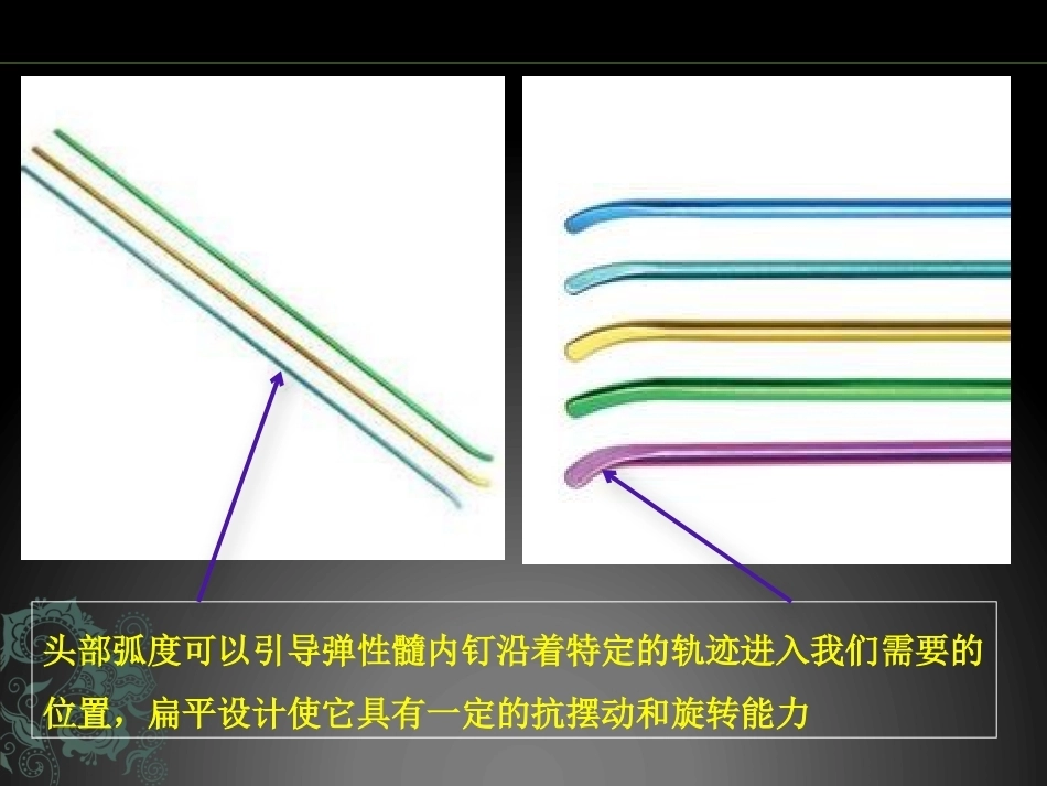 儿童长骨骨折弹性髓内钉课件_第3页