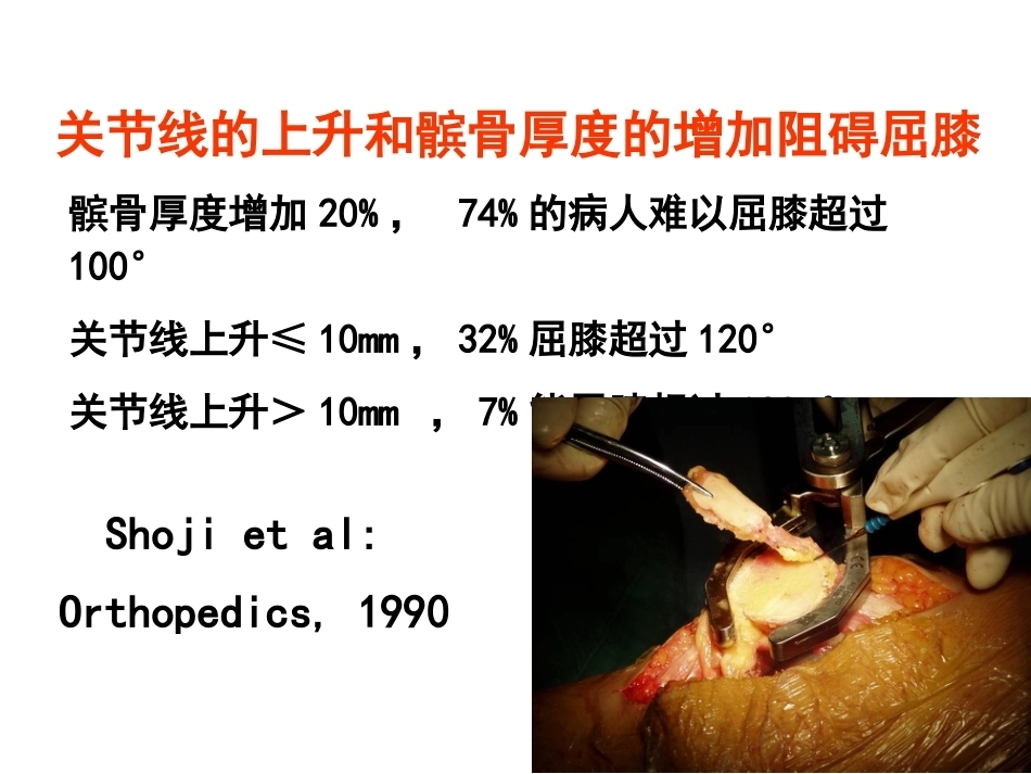 全膝 关节置换的 手术原则_第10页