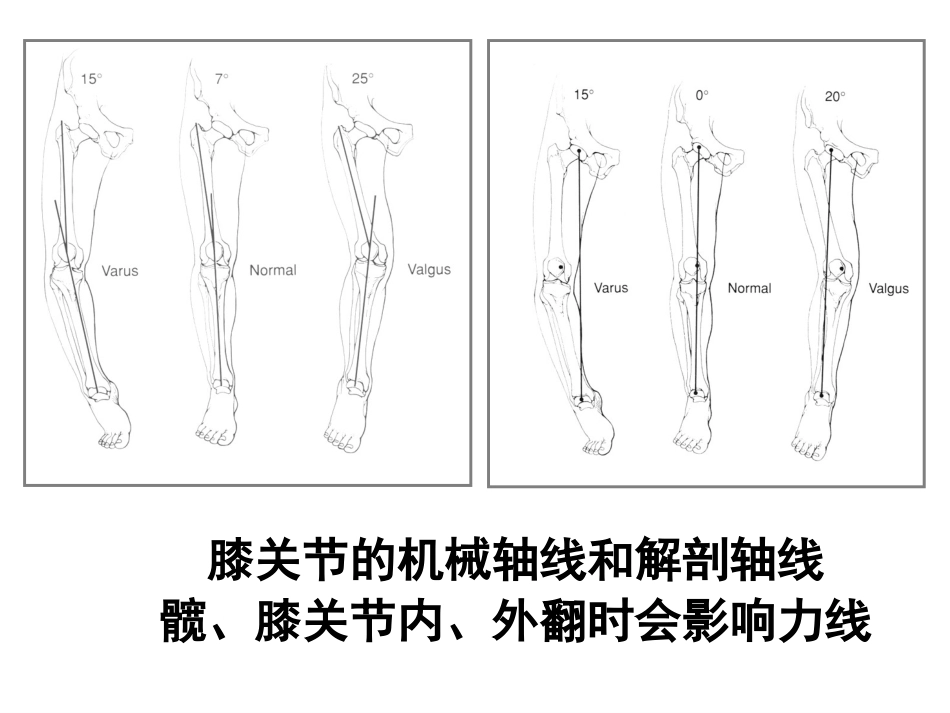 全膝 关节置换的 手术原则_第5页