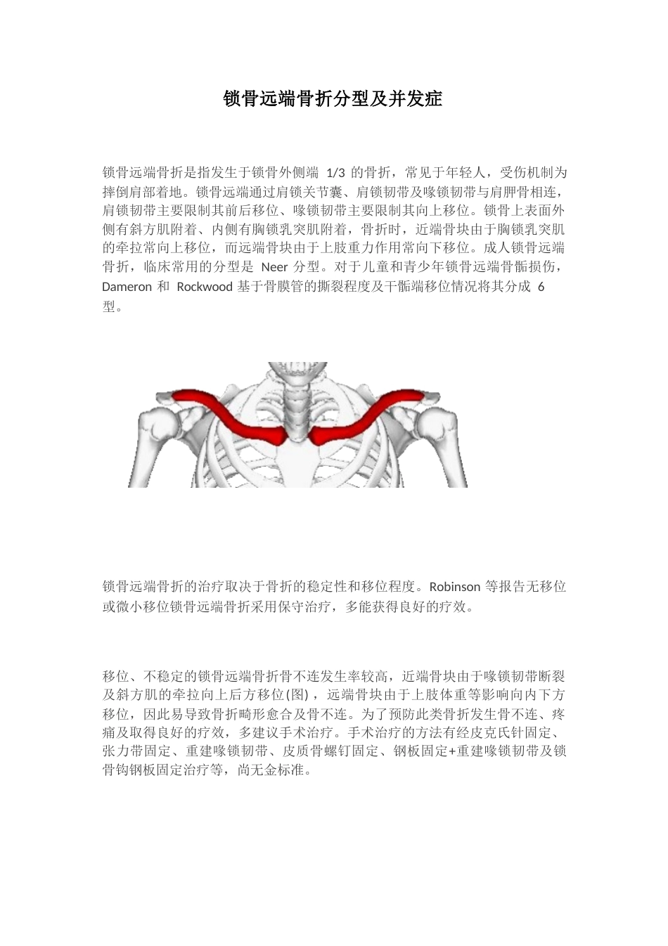 锁骨远端骨折分型_第1页