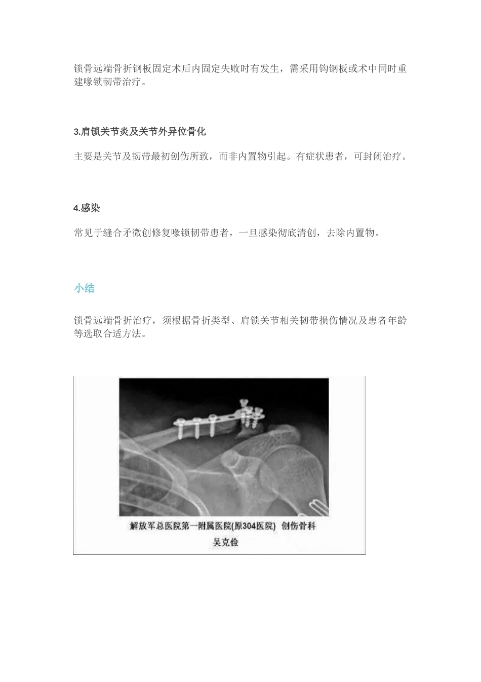 锁骨远端骨折分型_第3页