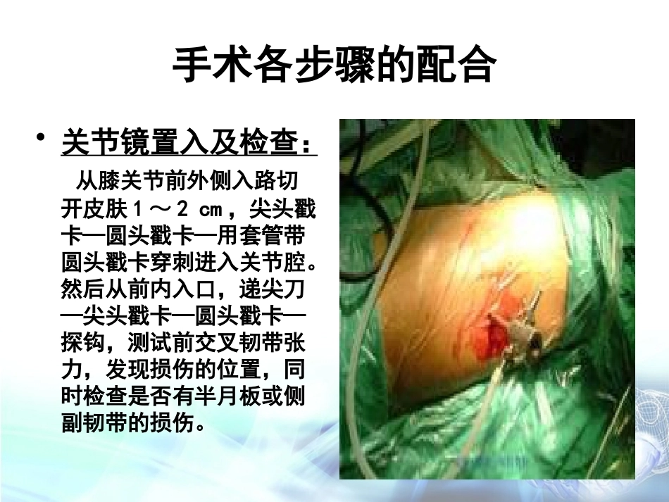 膝关节镜下前交叉韧 带重建术手术配合_第15页