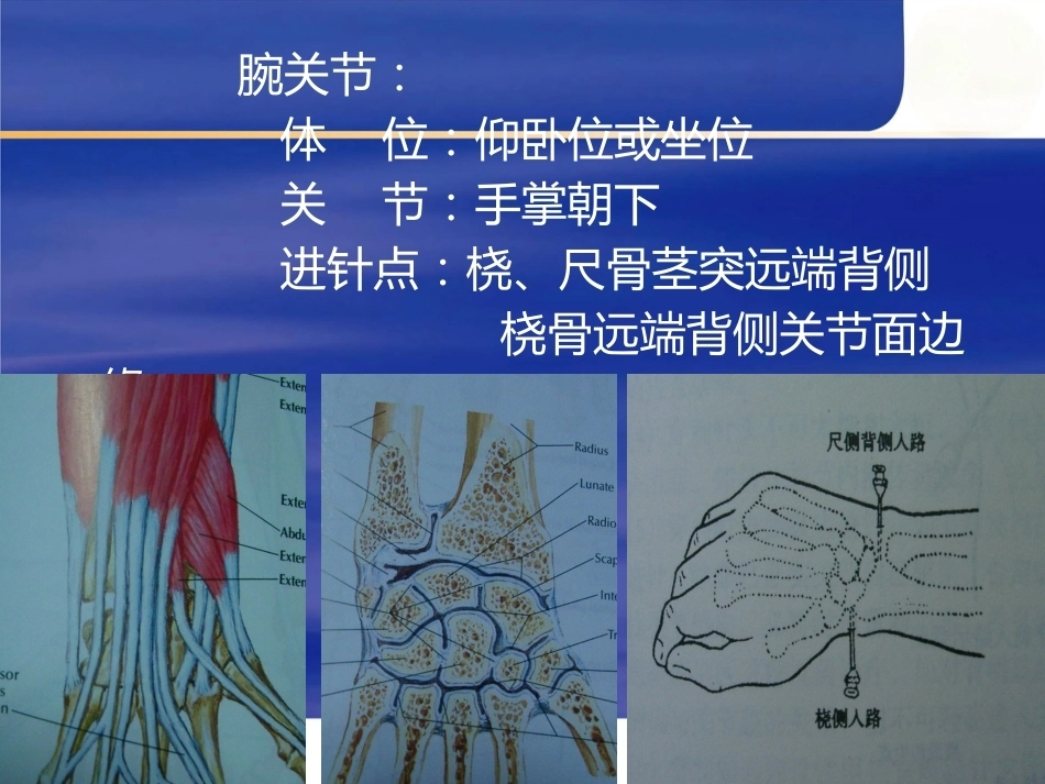 关节穿刺术_第10页