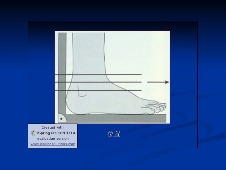 踝关节的MR诊断和解剖_第5页