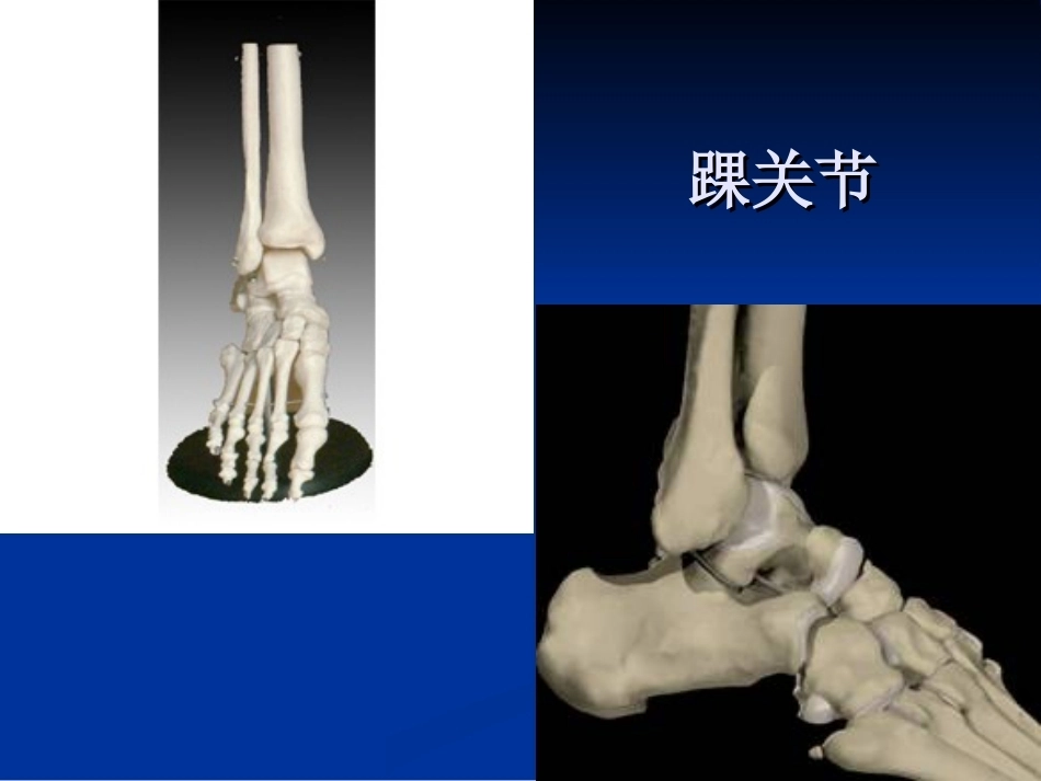 踝关节的MR诊断和解剖_第9页