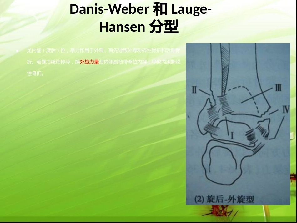 踝关节骨折的分型---讲课用_第14页