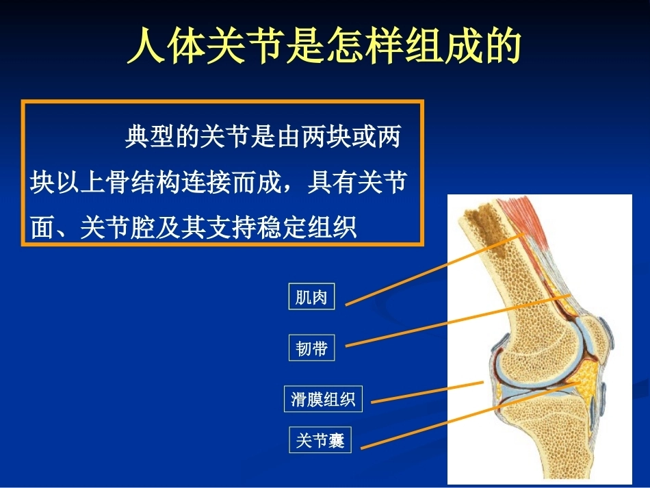 膝关节骨性关节炎的分 级治疗_第12页
