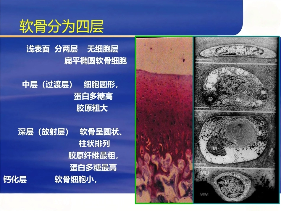 膝关节骨性关节炎的分 级治疗_第14页