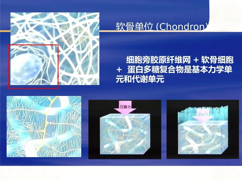 膝关节骨性关节炎的分 级治疗_第15页